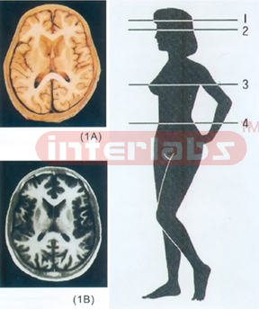 ANATOMICAL DISL MODEL OF FEMALE HUMAN TORSO Section 1